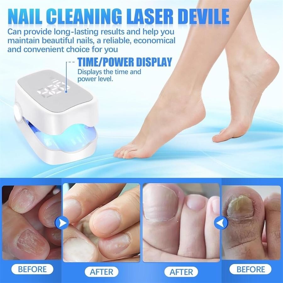 UV Nail Fungus Light Therapy Lamp