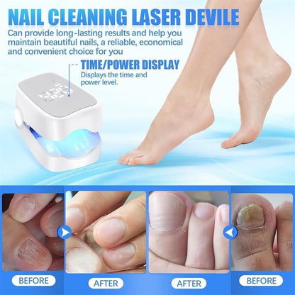 UV Nail Fungus Light Therapy Lamp